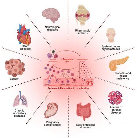 Systemic Illnesses Affecting the Liver