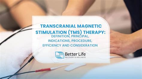 TMS Therapy Seattle Treatment