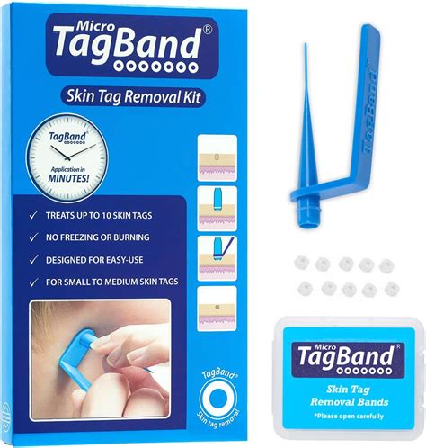 Feel Confident and Beautiful: Get Rid of Skin Tags with Tagband