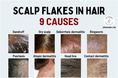 Targeting Specific Scalp Issues