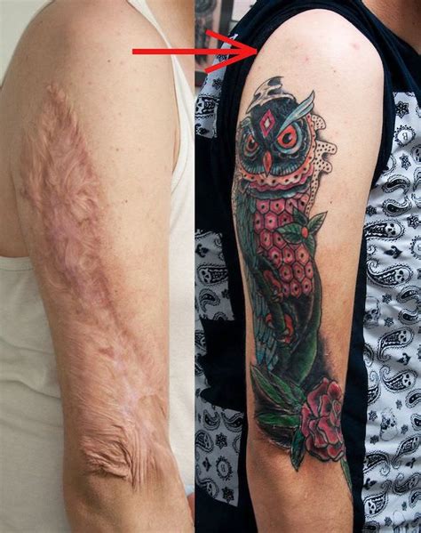 Can You Tattoo Over Scars & Scar Tissue? AuthorityTattoo