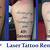 Tattoo Removal 3 Sessions