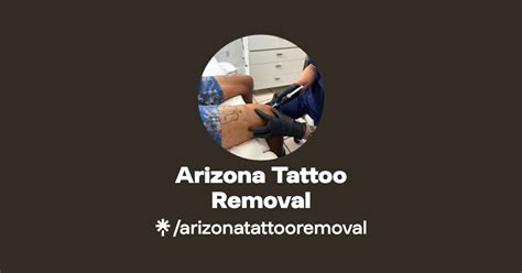 Laser Tattoo Removal Tattoo Removal Service Arizona