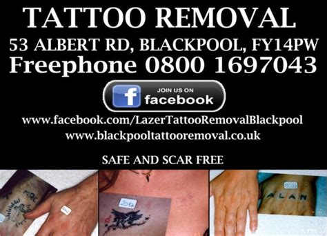Inkden Laser Tattoo Removal Clinic