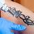 Tattoo Removal Cairns