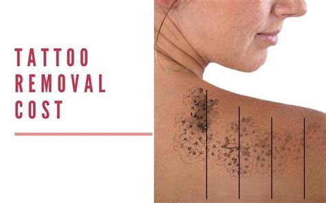 Affordable Tattoo Removal Cost in India , Tattoo Removal