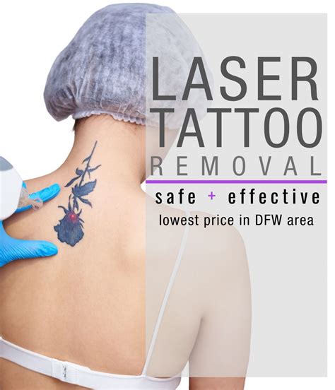 Laser Tattoo Removal Safe and Effective DallasFort