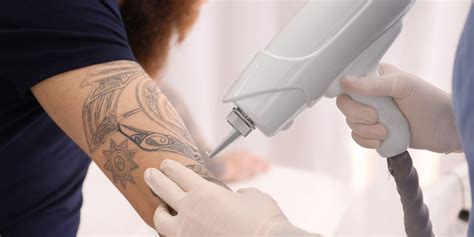 Tattoo removal Australia One third of inked people remove