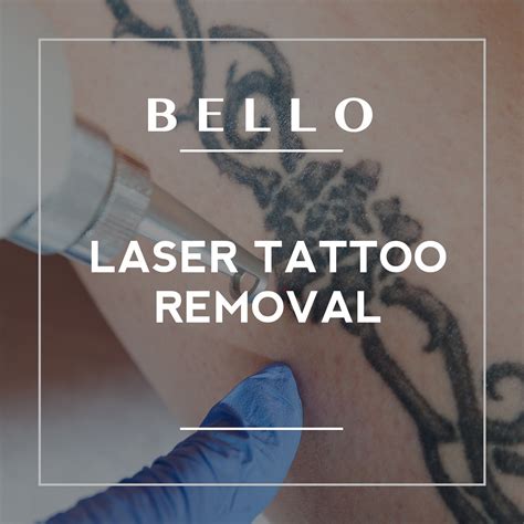 Our work tattoo removal clinic houston tx