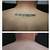 Tattoo Removal In Houston