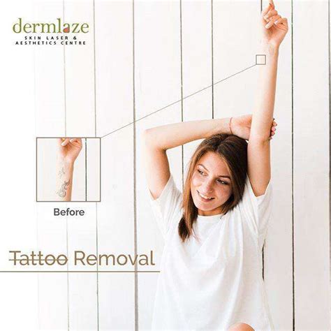 The 6 Shops for the Best Tattoo Removal in Kuala Lumpur [2020]