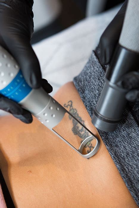 Phoenix Tattoo & Removal Tattoo Studio, Laser Tattoo Removal