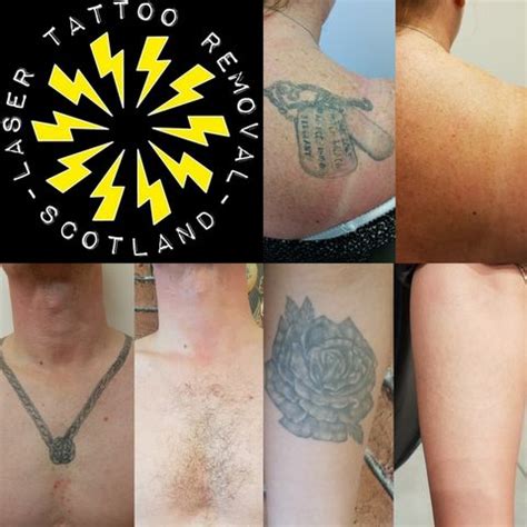 Scottish gang members offered tattoo removals Daily Record