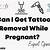 Tattoo Removal While Pregnant