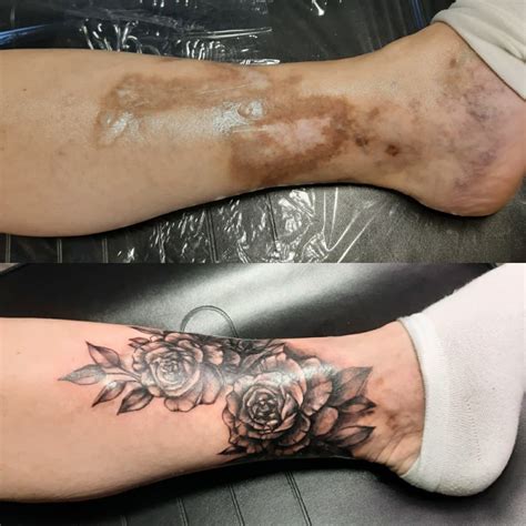 Tattoo Covering Scars