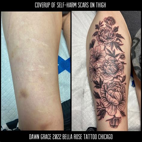 Tattoo Ideas For Covering Scars