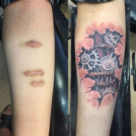 Tattoo Over Keloid Scar