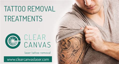 Tattoo Removal Jonesboro Ar Tatto Pictures