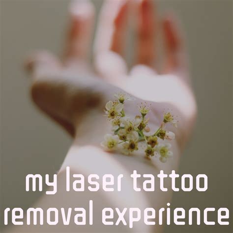 My Tattoo Removal Story TatRing