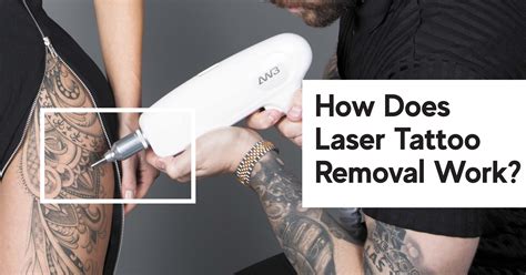 Tattoo Removal Training