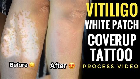 Transform Your Ink: Unleashing the Artistry of Tattoo Skin Color Cover Up