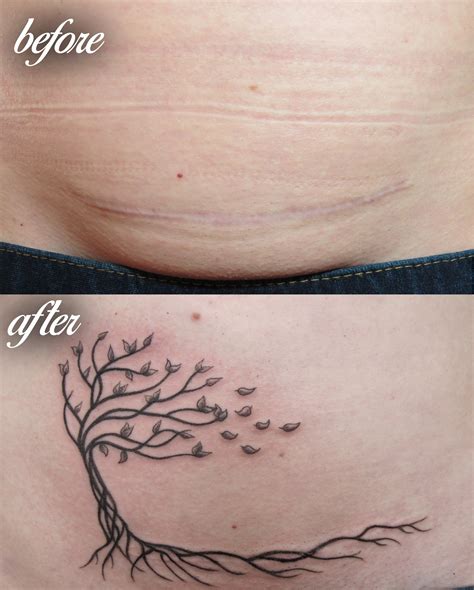 Tattoo To Cover C Section Scar