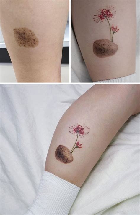 Tattoo To Cover Up Birthmark