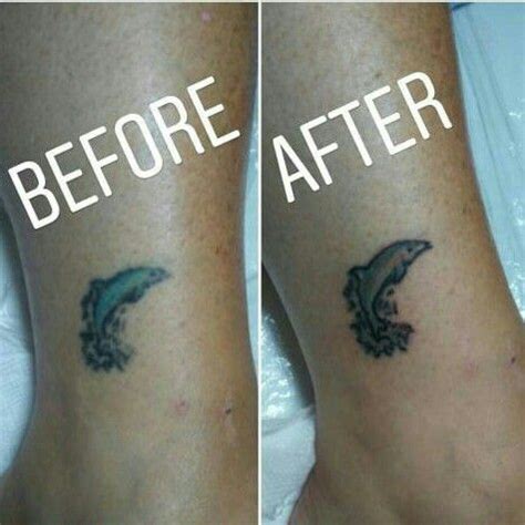 Tattoo Touch Up Before And After