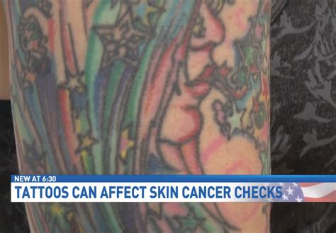 Tattoos And Skin Cancer