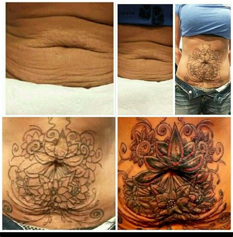 Tattoos to Cover Stretch Marks the Art of Camouflage