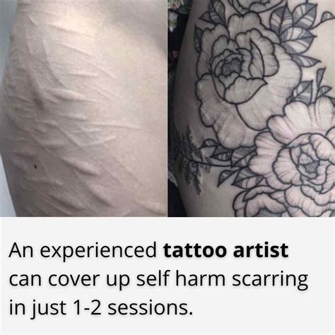 15 Scar Cover Up Tattoos Turned Into Works Of Art Can