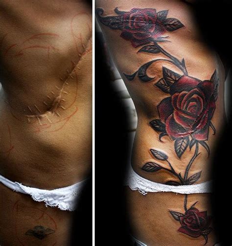 Tattoos To Cover Scars