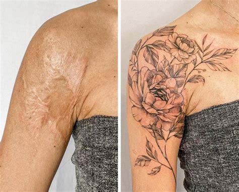 Tattoos To Disguise Scars
