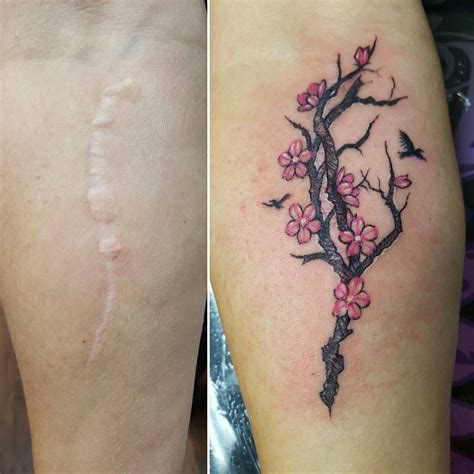 Tattoos To Hide Scars