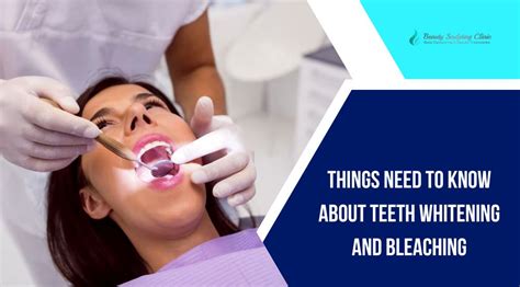 Teeth Bleaching: 5 Things to Know First.