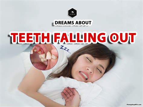 Teeth Falling Out Dream