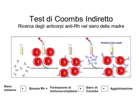 Test di Coombs perché è importante in gravidanza Roba da Donne