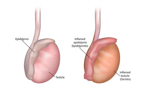 Testicle Itch: Causes & Fast Relief Solutions