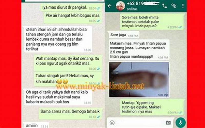 Testimoni Terapi Lintah Untuk Jerawat