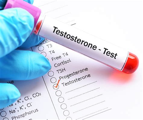 Testosterone Test