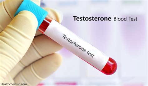 Testosterone Test Procedure