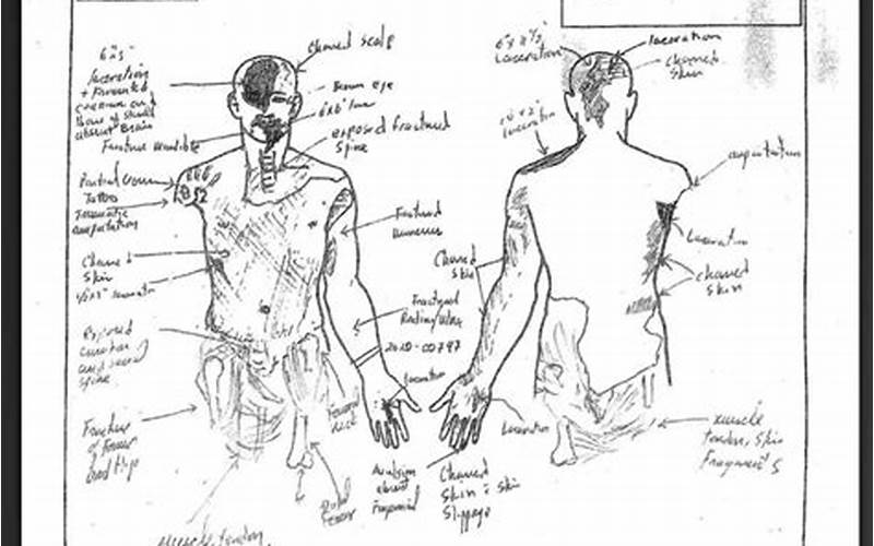 The Autopsy Sketches