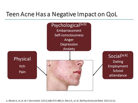 The Psychological Effects of Acne