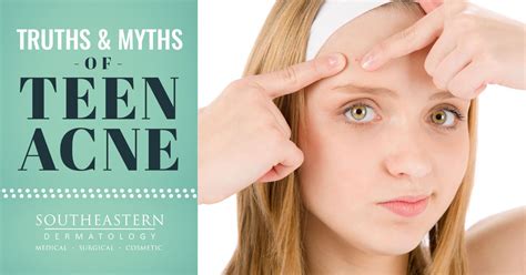 10 MYTHS ABOUT ACNE Acne, How to get rid of acne, Myths