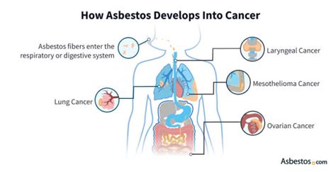 The Asbestos Connection: The Root Cause