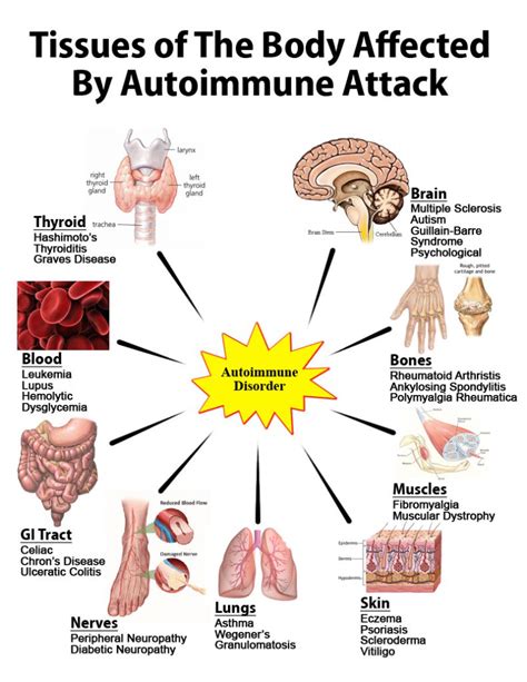 The Autoimmune Attack