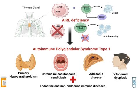 The Autoimmune Connection in Type 1