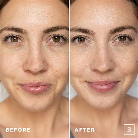 Reveal Radiant Beauty with the Ultimate Skin Perfecter: Unraveling the Secrets of Flawless Complexion!