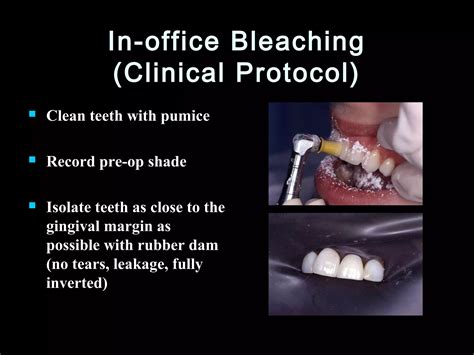 The Bleaching Protocol: Achieving That Perfect Level 10 Lift