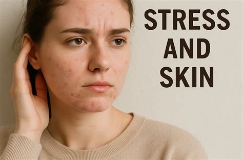 The Connection Between Chronic Stress And Skin Problems